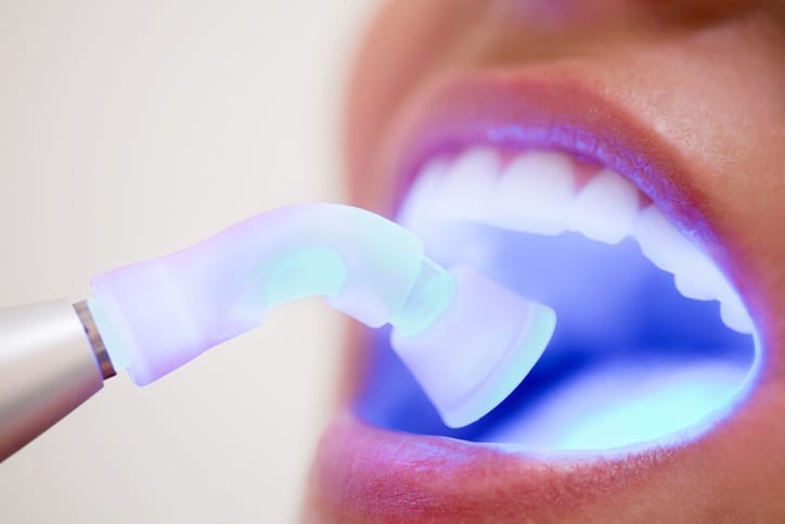 Laser Pocket Disinfection Therapy